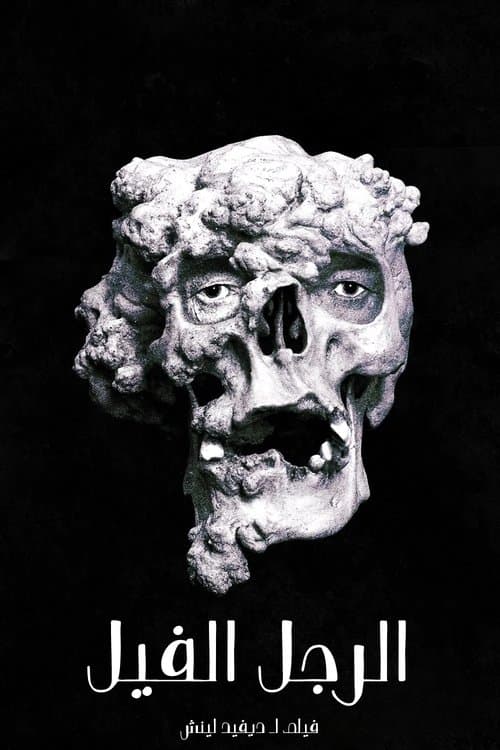 The Elephant Man